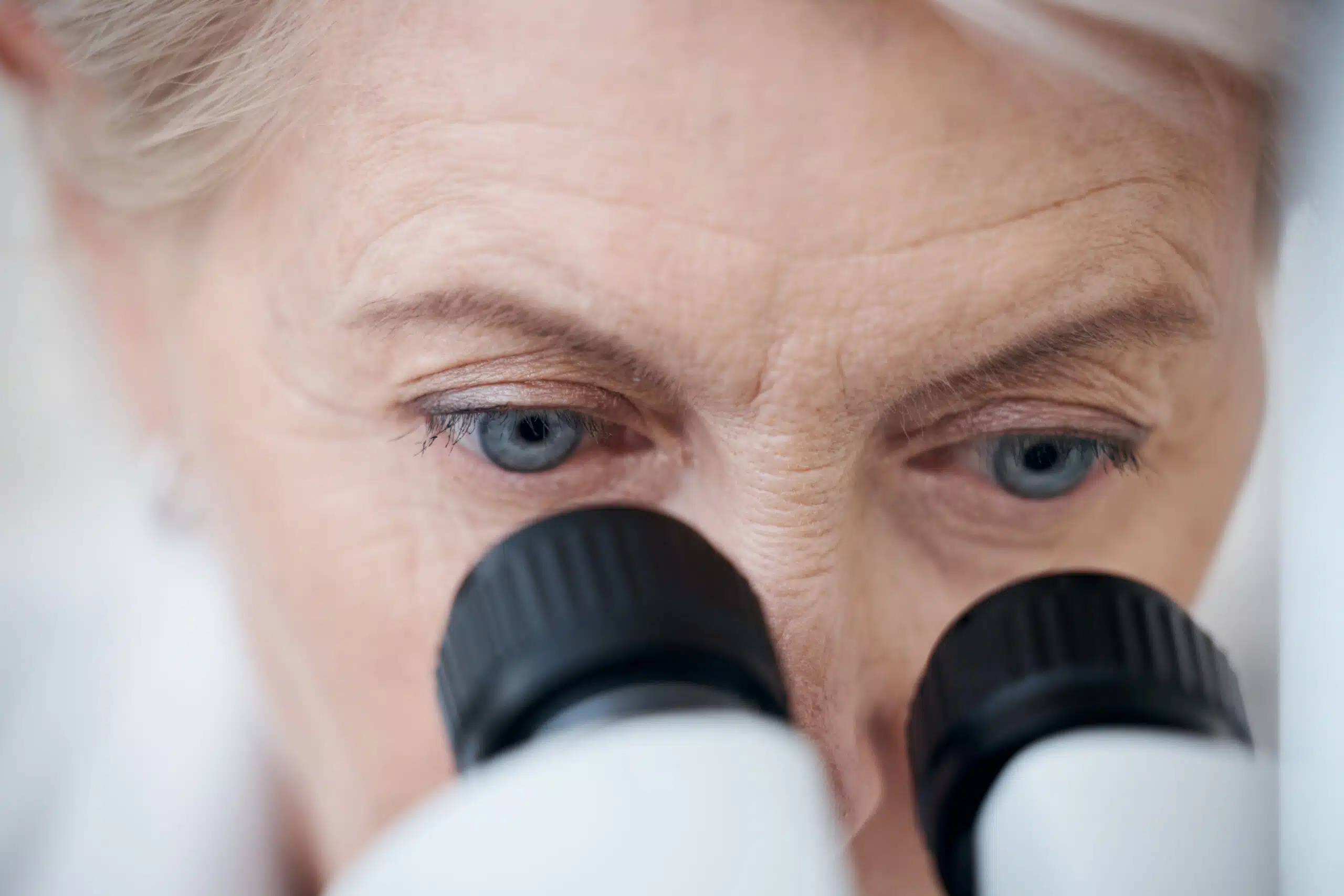 Rétinopathie diabétique : comment protéger ses yeux quand on est diabétique ?