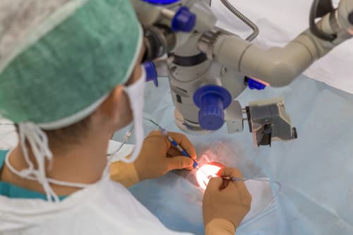 Chirurgie de la cataracte